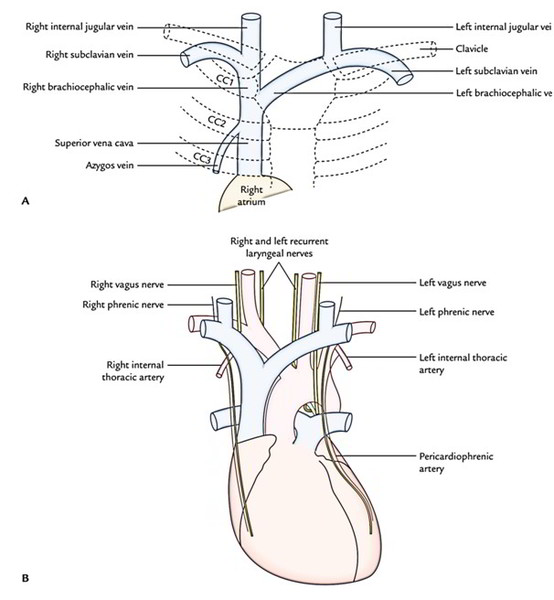 Метод кава. Tributaries of Superior Vena Cava. Синдром Вена кава Супериор. The tributaries of the right brachiocephalic Vein. На что делятся Cava Superior схема.