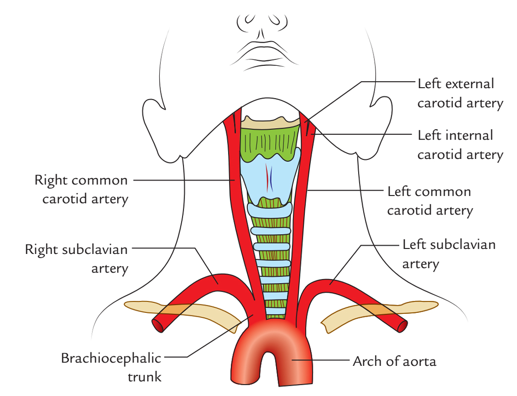 Common Carotid Artery Internal Carotid Artery Carotid Artery Arteries
