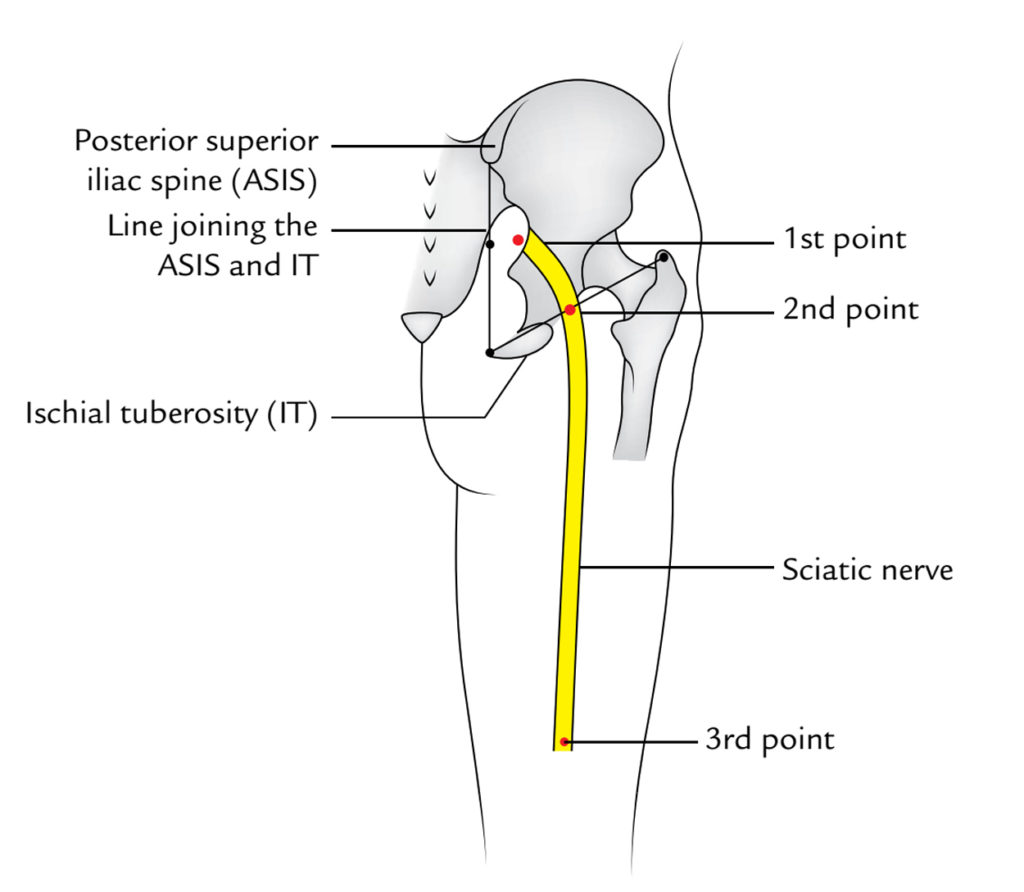 Sciatic Nerve Pathway Anatomy