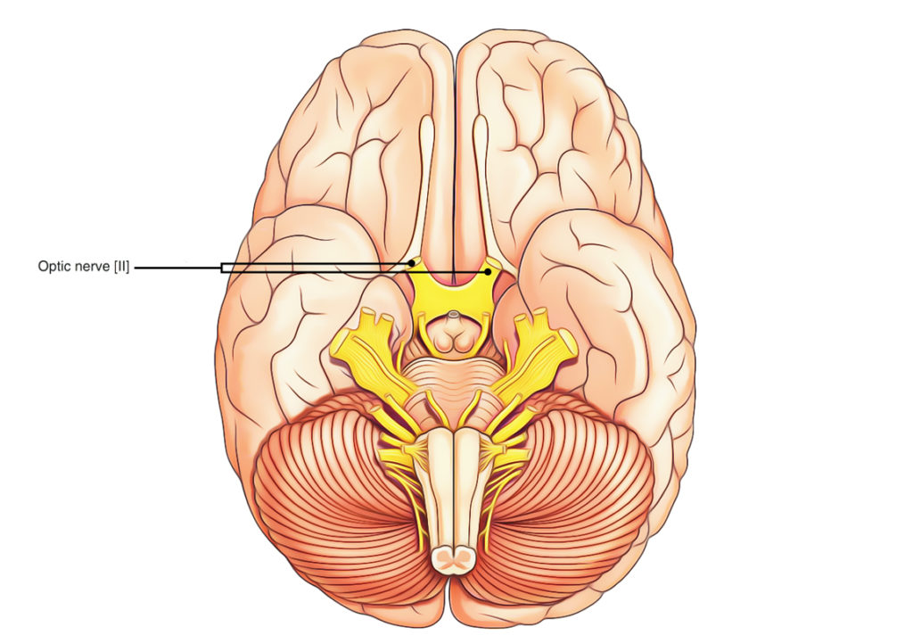 Optic Nerve Not Defined