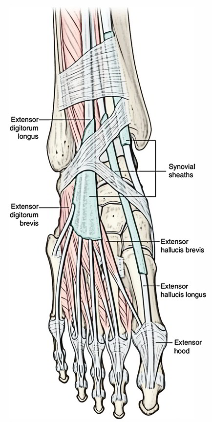 Extensor Digitorum Longus Tendonitis