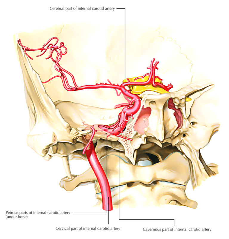 Internal Carotid Artery â€