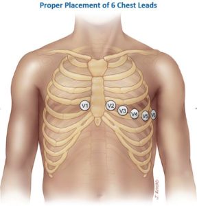 Axillary Lines – Anterior, Midaxillary and Posterior – Earth's Lab